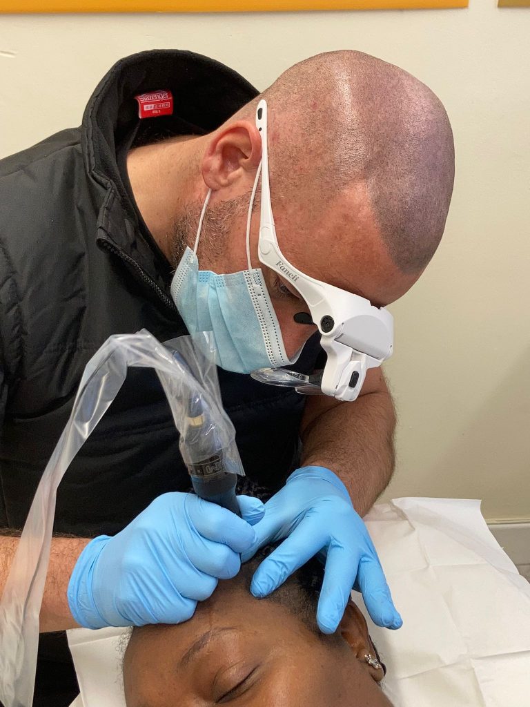 About Ultimate Scalp SMP Micropigmentation Leicester